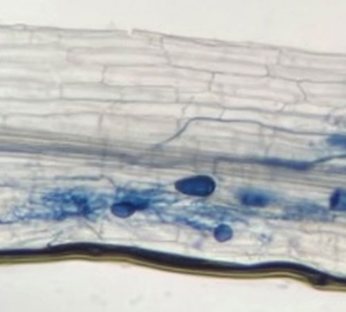 Imagen microscopio