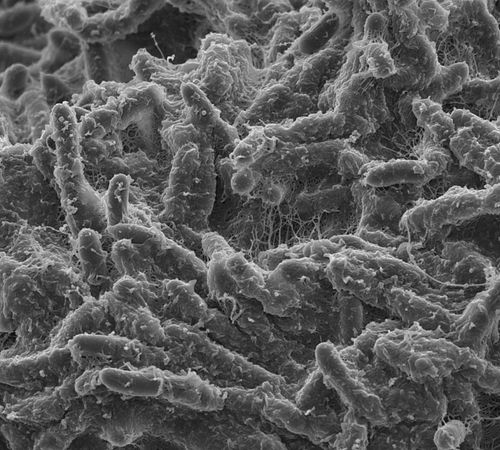 Imagen del microscopio de biopolímeros bacterianos