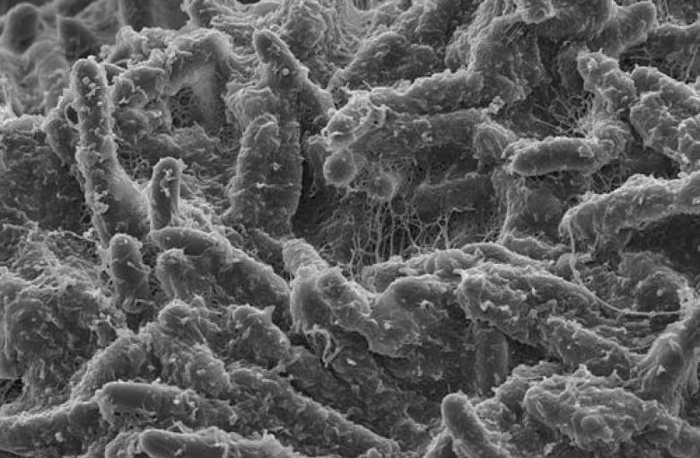 Imagen del microscopio de biopolímeros bacterianos